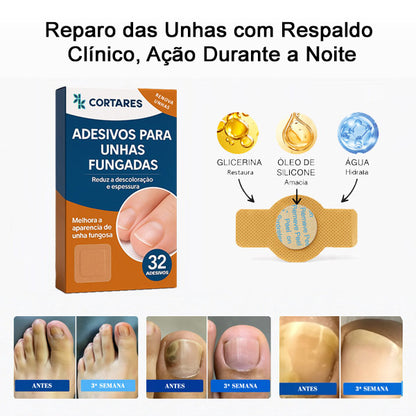 Cortares™ – Adesivo Antifúngico para Unhas